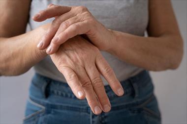El camino hacia la Remisi�n: avances en el tratamiento de la Artritis Reumatoide